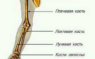 Перелом руки — симптоматика и лфк при реабилитации