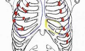 Перелом грудной клетки и его симптомы