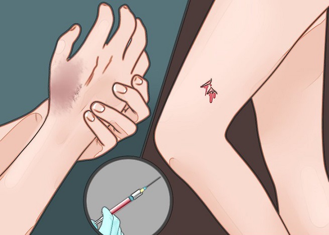 Когда делают экстренную вакцину