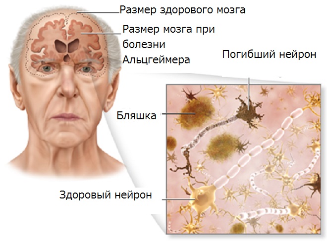 Что происходит в клетках