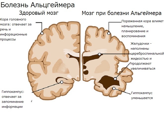 Что происходит в мозгу