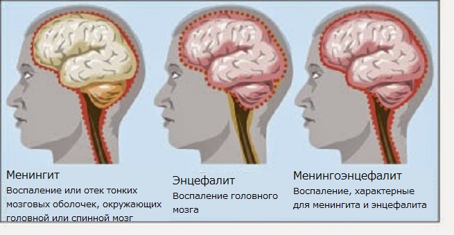 Различия болезней
