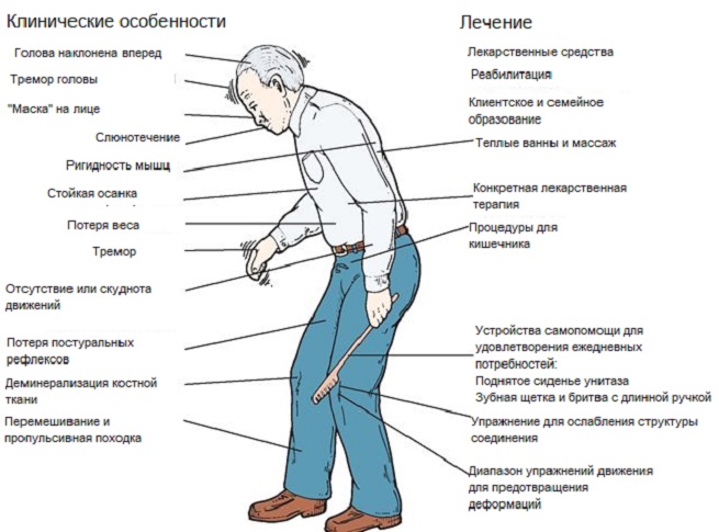 Симптомы и лечение