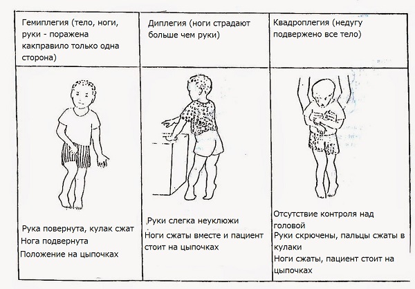 Отличие болезней