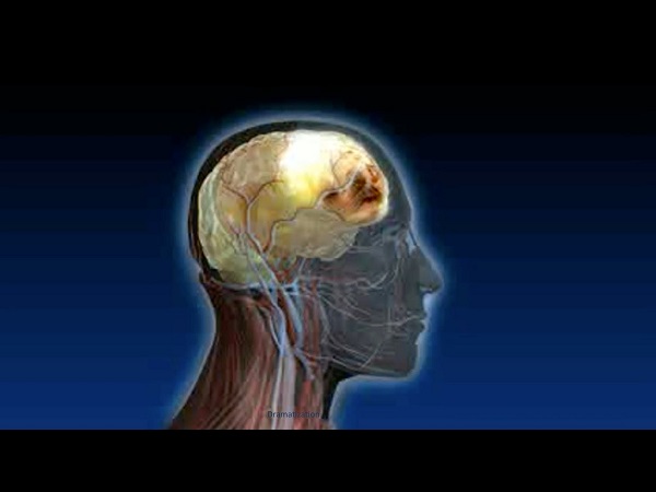 Так выглядит кровоподтек