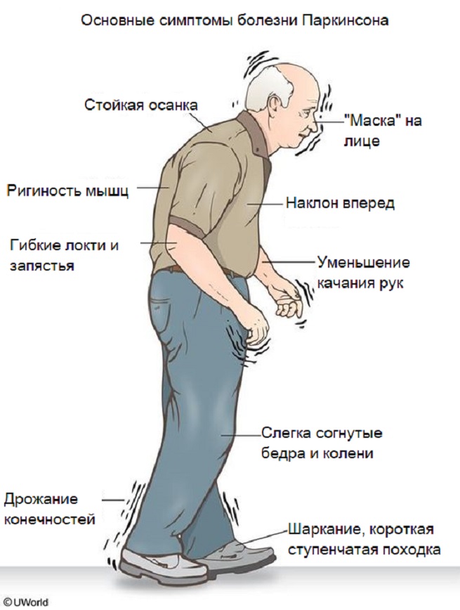 Симптомы