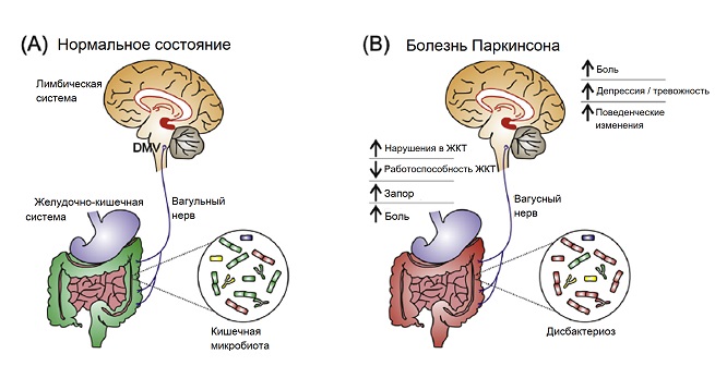 Мозг в разрезе