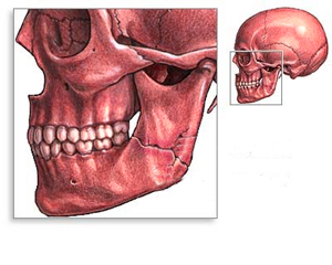 Перелом челюсти - симптомы и последствия 1 челюсть