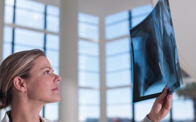 Патологические переломы костей: причины и особенности лечения 2 doctor reviewing x ray 170749321 597f69dd9abed50010ce5677