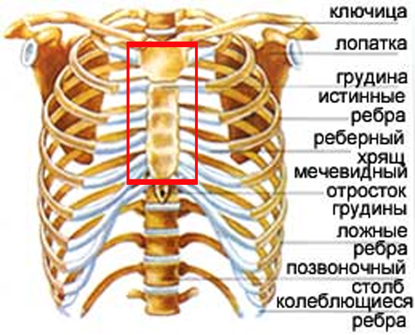 Перелом грудины и его лечение 1 Перелом грудины