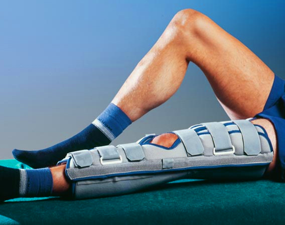 Перелом коленного сустава 5 Реабилитация при переломе коленного сустава