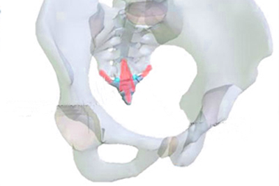 Симптомы самых распространенных переломов 4 Симптомы перелома копчика