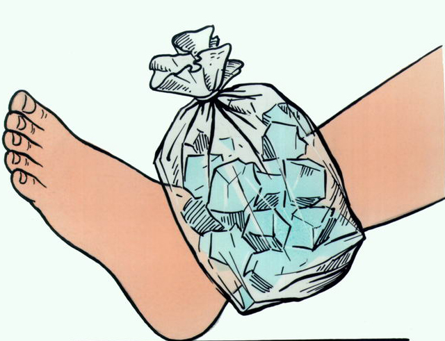 Приложите лёд к травмированному суставу Приложите лёд к травмированному суставу