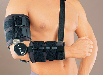 Перелом локтевого сустава 5 реабилитация при переломе локтевого сустава