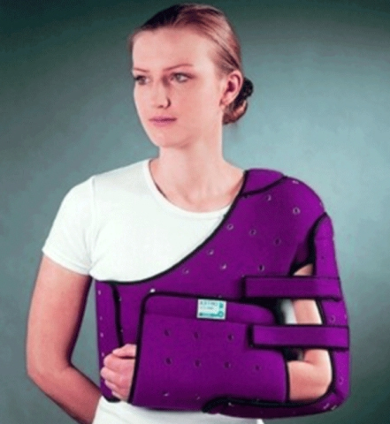 Перелом лопатки, а так же лечение и первая помощь 3 Лечение перелома лопатки