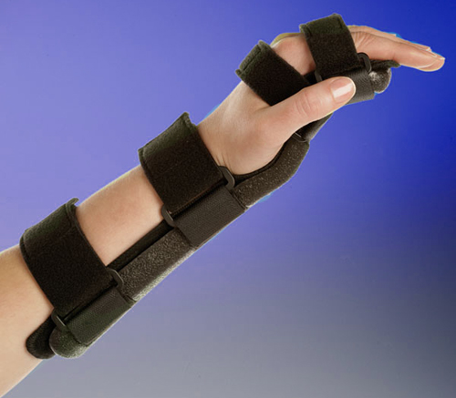 Перелом лучезапястного сустава 3 Лечение повреждений лучезапястного сустава