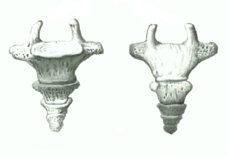 Перелом копчика. Симптомы, лечение и реабилитация 1 перелом копчика