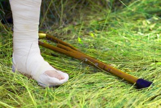 реабилитация после перелома пятки