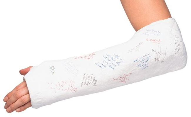 Перелом руки - симптоматика и лфк при реабилитации 3 реабилитация при переломе руки