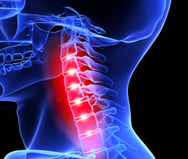 Перелом шеи и его последствия 1 Перелом шеи