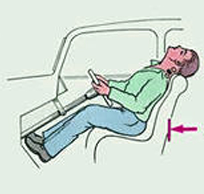 причины перелома шеи