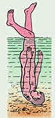 купание в незнакомых местах приводит к перелому шеи