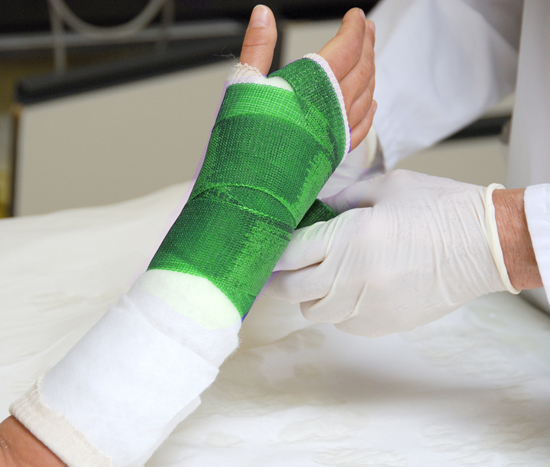 Симптомы перелома запястья, а так же его леччение и ЛФК 3 лечение перелома запястья