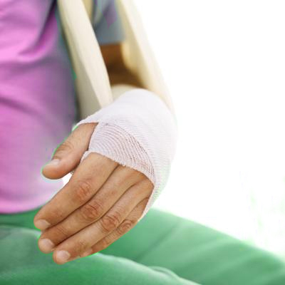 Симптомы перелома запястья, а так же его леччение и ЛФК 4 гипс при переломе запястья