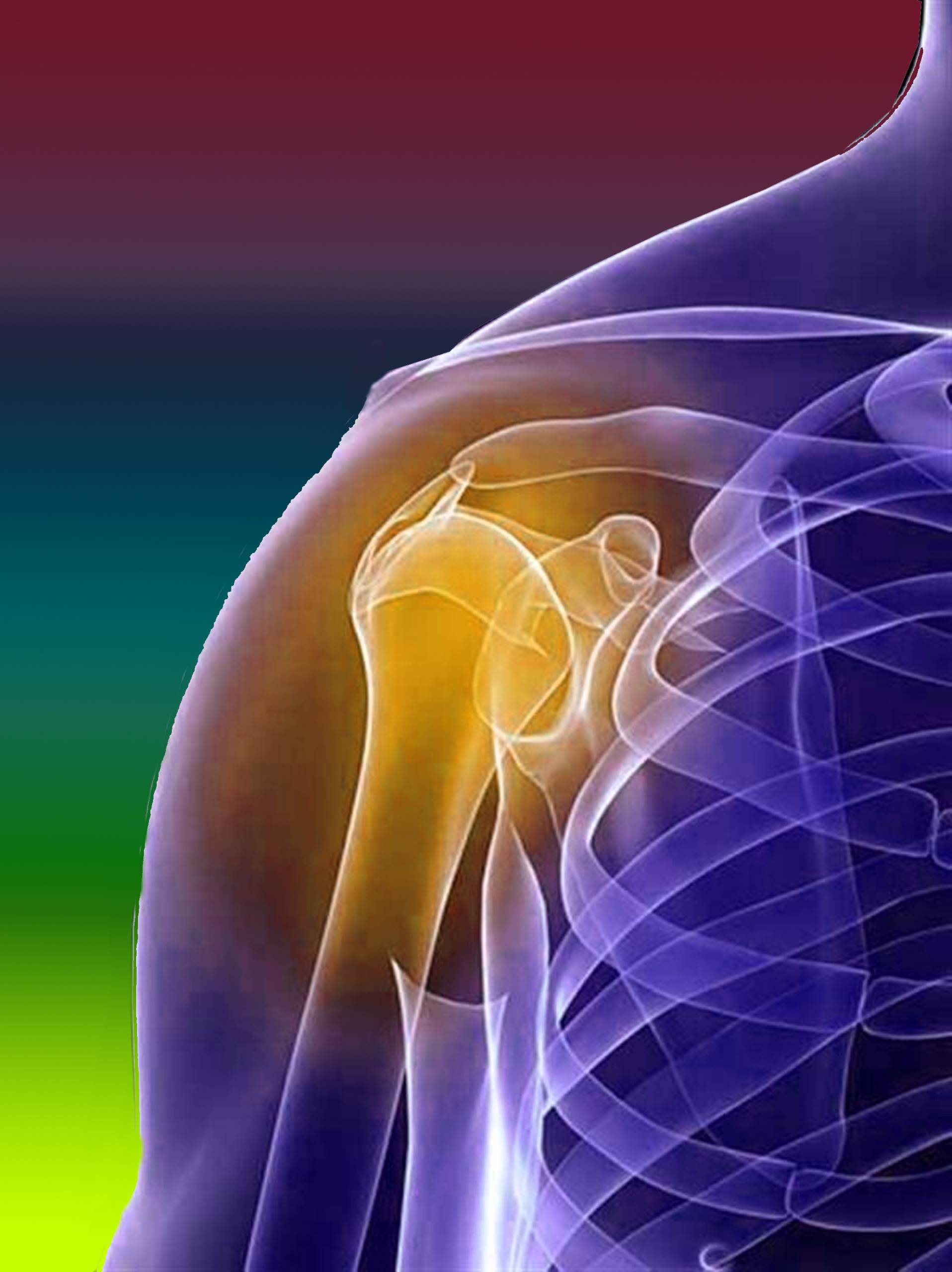 Перелом плечевого сустава и его лечение 3 Виды переломов плечевого сустава